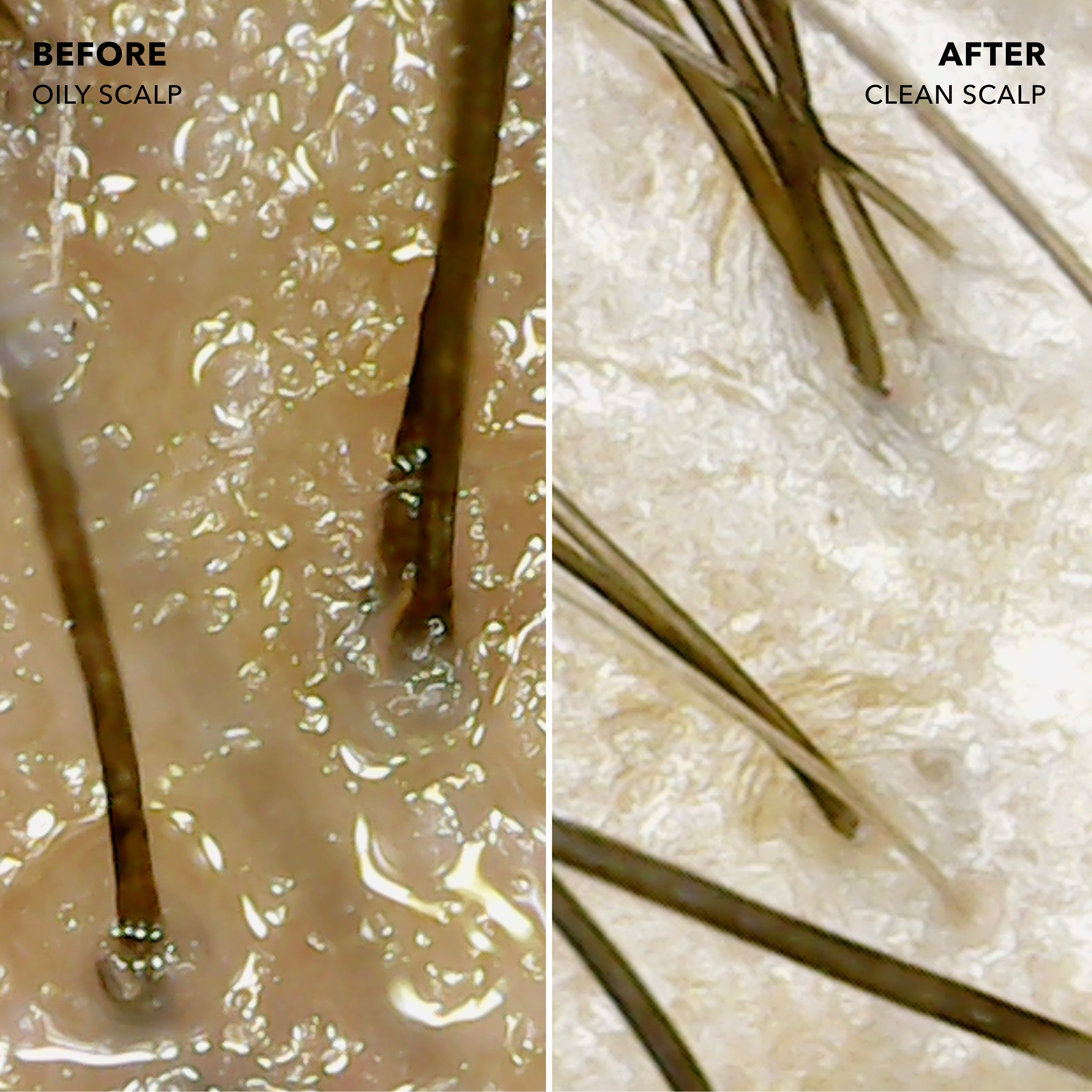 Travel Root Refresh Micellar Rinse Dry Shampoo Alternative Infused with Apple Cider Vinegar